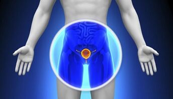 Trattamento della prostatite con farmaci