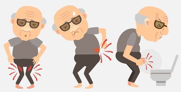 sintomi della prostatite e il suo trattamento con farmaci